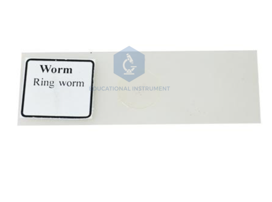 Ringworm Slide